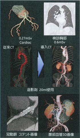 CT画像